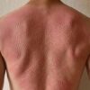 シャクティマットを使用した後の背中
