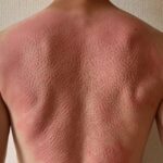シャクティマットを使用した後の背中
